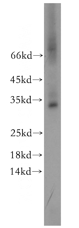 Jurkat cells were subjected to SDS PAGE followed by western blot with Catalog No:108714(C2orf49 antibody) at dilution of 1:500