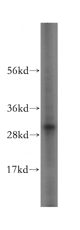 HeLa cells were subjected to SDS PAGE followed by western blot with Catalog No:112660(MITD1 antibody) at dilution of 1:500