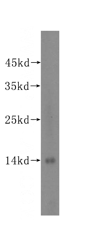 Jurkat cells were subjected to SDS PAGE followed by western blot with Catalog No:108314(ATP6V1G1 antibody) at dilution of 1:500