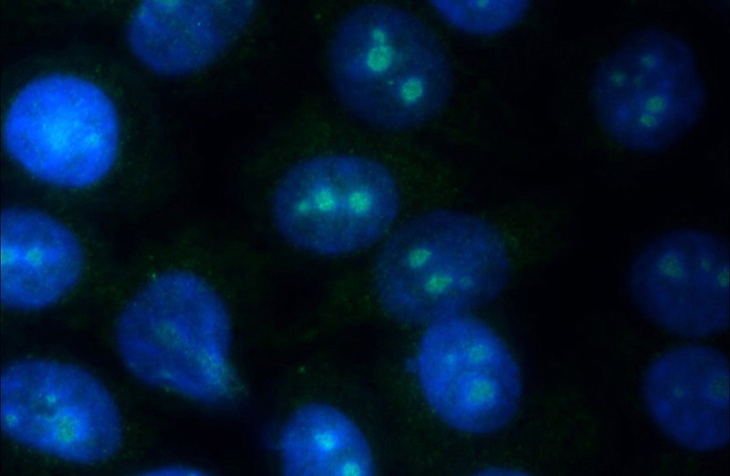 Immunofluorescent analysis of HepG2 cells using Catalog No:114073(POU4F2 Antibody) at dilution of 1:25 and Alexa Fluor 488-congugated AffiniPure Goat Anti-Rabbit IgG(H+L)