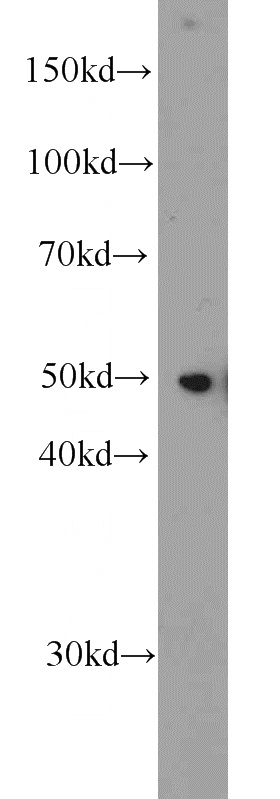 HepG2 cells were subjected to SDS PAGE followed by western blot with Catalog No:110310(EEF1A1 antibody) at dilution of 1:1000