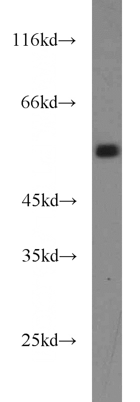 mouse liver tissue were subjected to SDS PAGE followed by western blot with Catalog No:114935(RUNX1 antibody) at dilution of 1:500