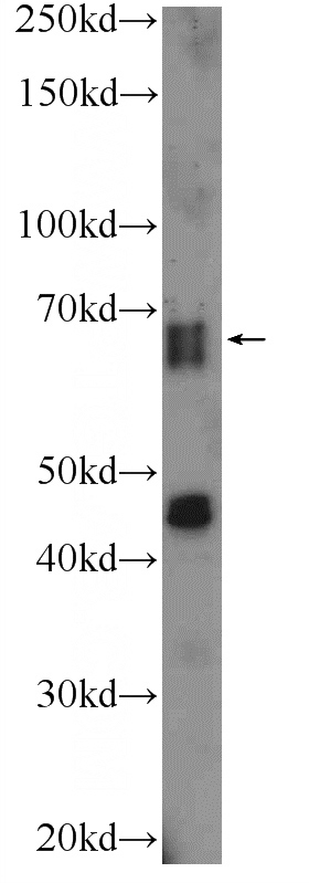 mouse brain tissue were subjected to SDS PAGE followed by western blot with Catalog No:115293(SLAIN2 Antibody) at dilution of 1:300