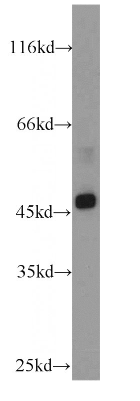 HepG2 cells were subjected to SDS PAGE followed by western blot with Catalog No:115751(SUV39H1 antibody) at dilution of 1:1000
