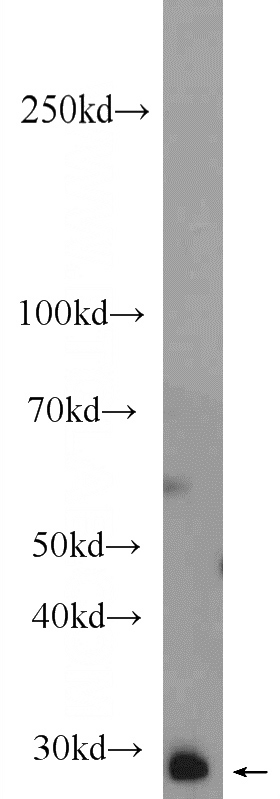 mouse testis tissue were subjected to SDS PAGE followed by western blot with Catalog No:112329(LRRC18 Antibody) at dilution of 1:600