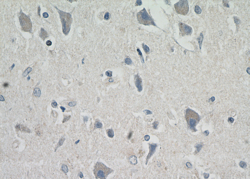 Immunohistochemical of paraffin-embedded human brain using Catalog No:112800(MRAP2 antibody) at dilution of 1:50 (under 40x lens)