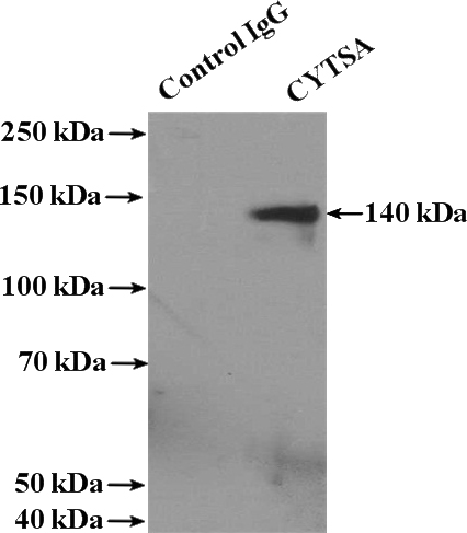 IP Result of anti-CYTSA (IP:Catalog No:109815, 4ug; Detection:Catalog No:109815 1:1000) with mouse brain tissue lysate 4000ug.