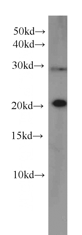 A549 cells were subjected to SDS PAGE followed by western blot with Catalog No:107498(RBBP9 antibody) at dilution of 1:500