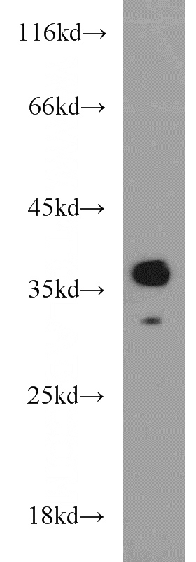 mouse brain tissue were subjected to SDS PAGE followed by western blot with Catalog No:108926(CAMLG antibody) at dilution of 1:1000