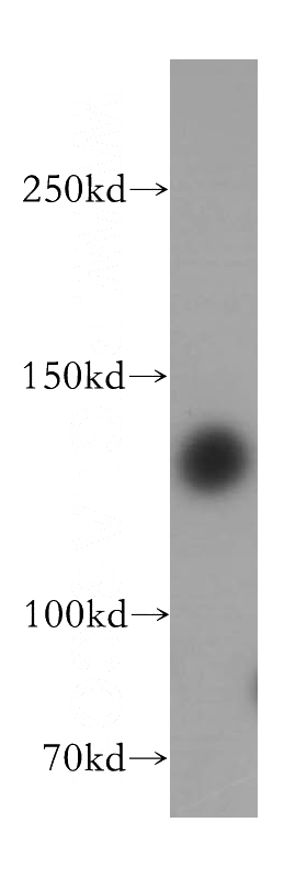 HeLa cells were subjected to SDS PAGE followed by western blot with Catalog No:111377(HDAC4 antibody) at dilution of 1:300