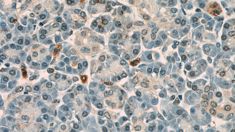 Immunohistochemistry of paraffin-embedded human pancreas slide using Catalog No:110274(ELF1 Antibody) at dilution of 1:50