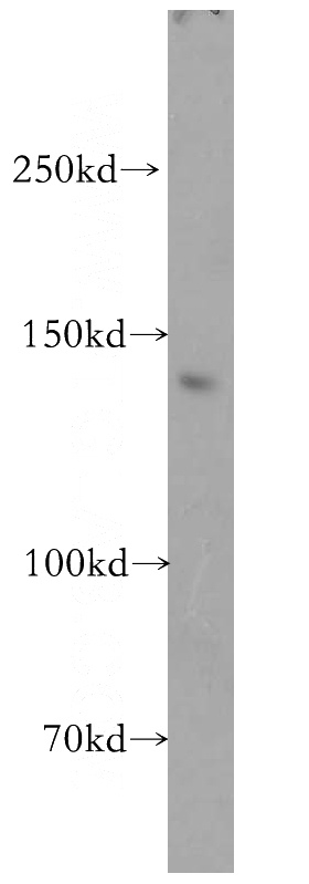 mouse ovary tissue were subjected to SDS PAGE followed by western blot with Catalog No:110022(UTP20 antibody) at dilution of 1:1500