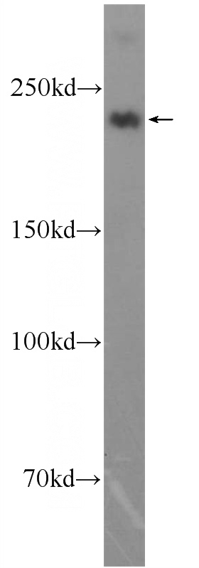 human skeletal muscle tissue were subjected to SDS PAGE followed by western blot with Catalog No:112927(MYH1 Antibody) at dilution of 1:1000