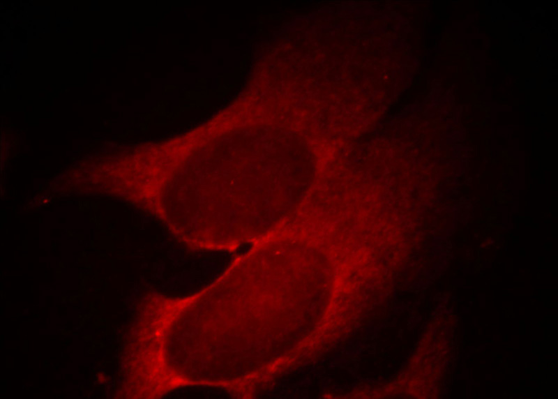 Immunofluorescent analysis of Hela cells, using IVD antibody Catalog No: at 1:25 dilution and Rhodamine-labeled goat anti-mouse IgG (red).