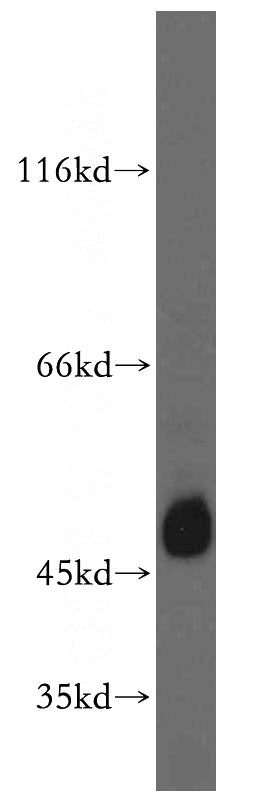 HL-60 cells were subjected to SDS PAGE followed by western blot with Catalog No:115958(TEX13A antibody) at dilution of 1:500