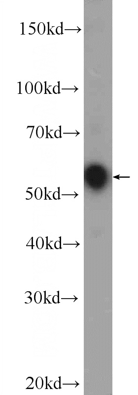 mouse brain tissue were subjected to SDS PAGE followed by western blot with Catalog No:108930(CNR1 Antibody) at dilution of 1:1000