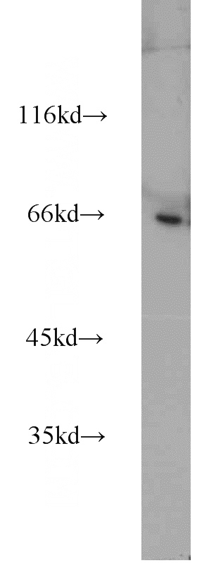 Sp2/0 cells were subjected to SDS PAGE followed by western blot with Catalog No:114160(PPWD1 antibody) at dilution of 1:1000