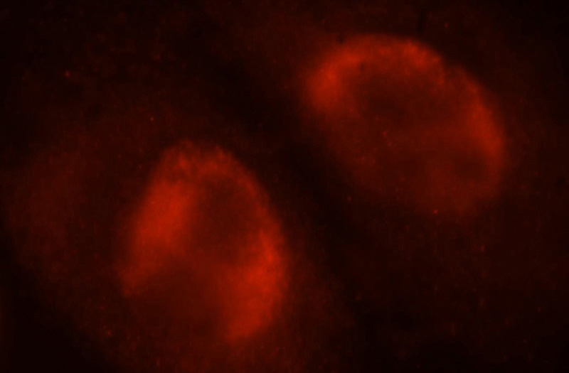 Immunofluorescent analysis of HepG2 cells, using SNRPA1 antibody Catalog No:115457 at 1:25 dilution and Rhodamine-labeled goat anti-rabbit IgG (red).