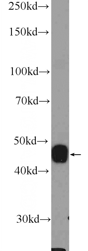 rat skeletal muscle tissue were subjected to SDS PAGE followed by western blot with Catalog No:109558(CRHR2 Antibody) at dilution of 1:600
