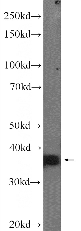 HEK-293 cells were subjected to SDS PAGE followed by western blot with Catalog No:115250(SIX2 Antibody) at dilution of 1:600