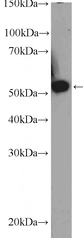 A431 cells were subjected to SDS PAGE followed by western blot with Catalog No:115884(TBRG4 Antibody) at dilution of 1:1000