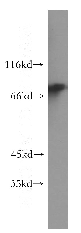 A2780 cells were subjected to SDS PAGE followed by western blot with Catalog No:113052(NDC80 antibody) at dilution of 1:500