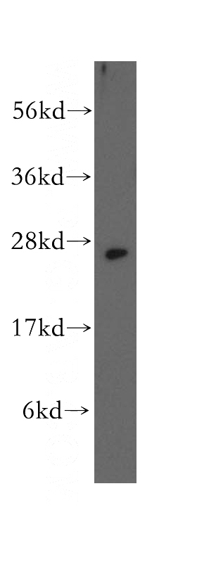 HeLa cells were subjected to SDS PAGE followed by western blot with Catalog No:115611(SSSCA1 antibody) at dilution of 1:500