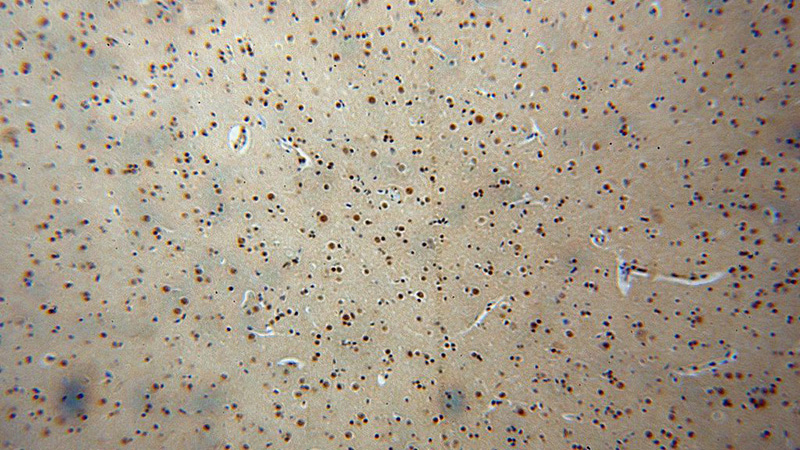 Immunohistochemical of paraffin-embedded human brain using Catalog No:114608(RBM26 antibody) at dilution of 1:100 (under 10x lens)