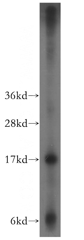 HepG2 cells were subjected to SDS PAGE followed by western blot with Catalog No:109508(PPP1R14A antibody) at dilution of 1:400