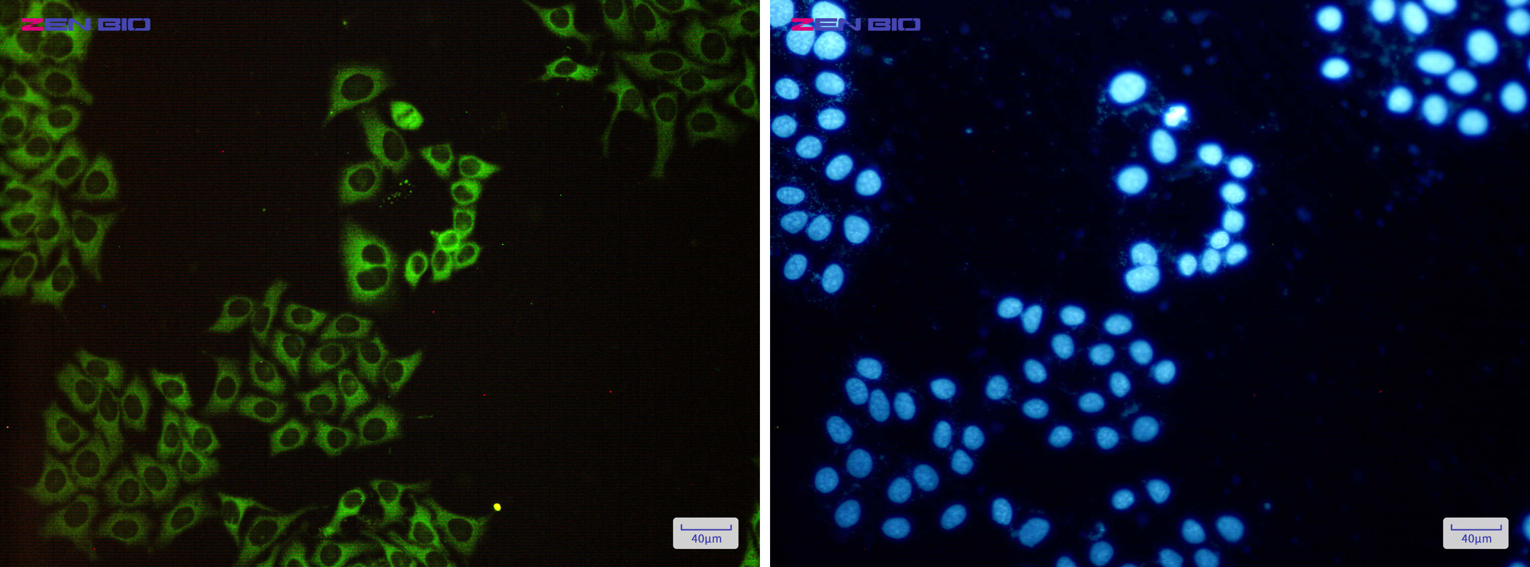 Immunocytochemistry of CAP1(green) in Hela cells using CAP1 Rabbit pAb at dilution 1/50, and DAPI(blue)