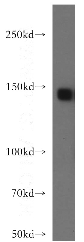 mouse brain tissue were subjected to SDS PAGE followed by western blot with Catalog No:115783(SYNGAP1 antibody) at dilution of 1:500