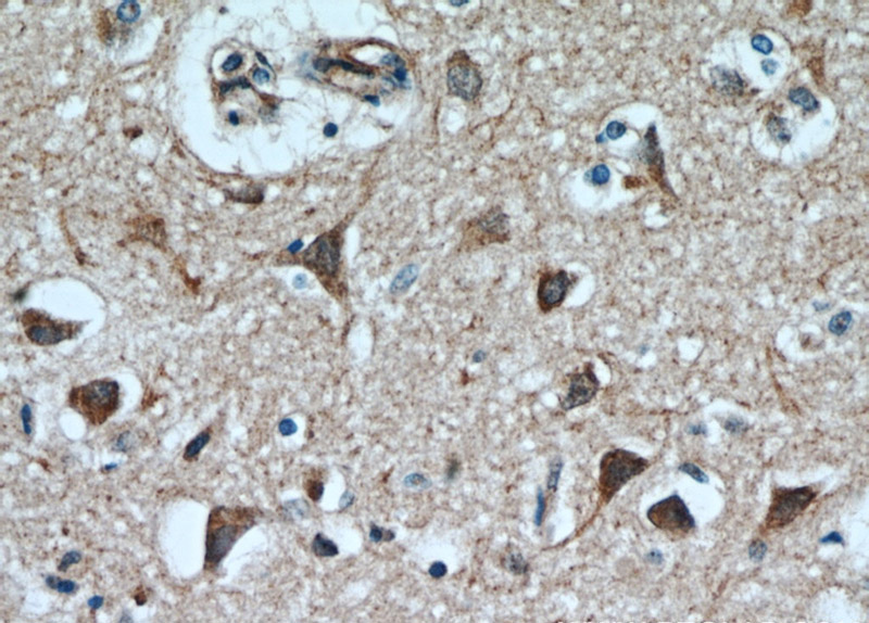 Immunohistochemical of paraffin-embedded human brain using Catalog No:109513(CPLX4 antibody) at dilution of 1:100 (under 40x lens)