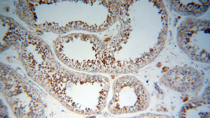 Immunohistochemical of paraffin-embedded human testis using Catalog No:113475(PABPC3 antibody) at dilution of 1:50 (under 10x lens)