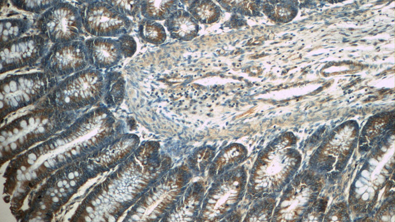 Immunohistochemistry of paraffin-embedded human colon tissue slide using Catalog No:116268(TPM3 Antibody) at dilution of 1:50 (under 10x lens)