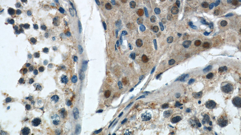Immunohistochemistry of paraffin-embedded human testis slide using Catalog No:111679(IGF2BP1 Antibody) at dilution of 1:50