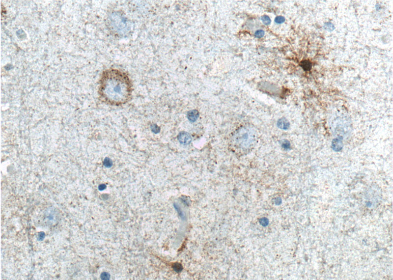 Immunohistochemistry of paraffin-embedded human brain tissue slide using Catalog No:107570(ALDH1A1 Antibody) at dilution of 1:200 (under 40x lens). heat mediated antigen retrieved with Sodium Citrate buffer (pH6).