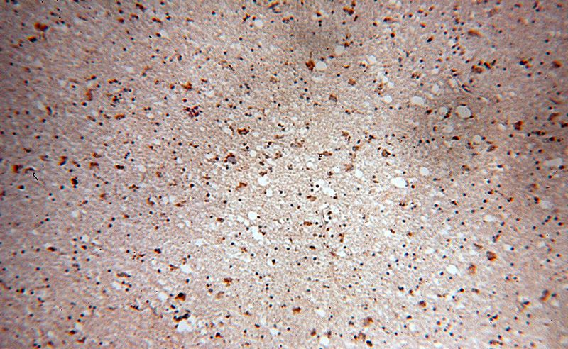 Immunohistochemical of paraffin-embedded human brain using Catalog No:112479(MARK2 antibody) at dilution of 1:50 (under 10x lens)