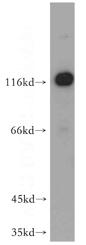 mouse colon tissue were subjected to SDS PAGE followed by western blot with Catalog No:113112(NELL1 antibody) at dilution of 1:200