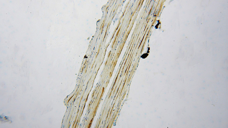 Immunohistochemical of paraffin-embedded human skeletal muscle using Catalog No:110614(FEM1A antibody) at dilution of 1:50 (under 10x lens)