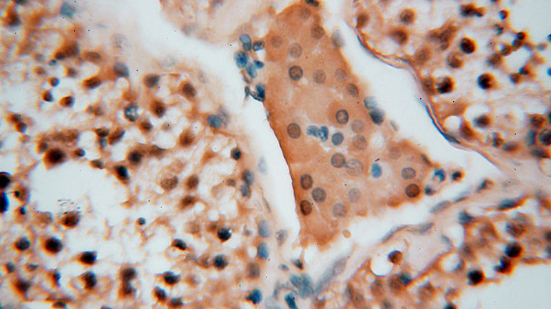 Immunohistochemical of paraffin-embedded human testis using Catalog No:108258(ADPRHL2 antibody) at dilution of 1:100 (under 40x lens)