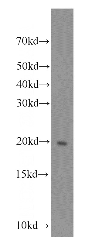 human testis tissue were subjected to SDS PAGE followed by western blot with Catalog No:115550(SPATA19 antibody) at dilution of 1:1000