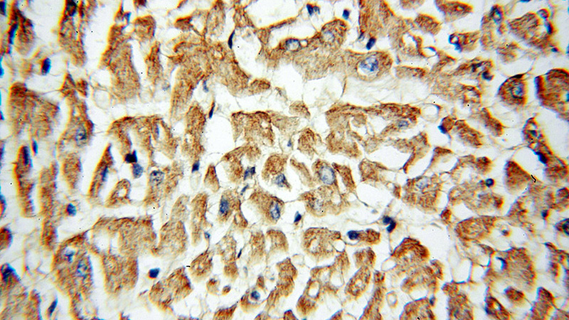 Immunohistochemical of paraffin-embedded human heart using Catalog No:109439(COL6A2 antibody) at dilution of 1:50 (under 40x lens)