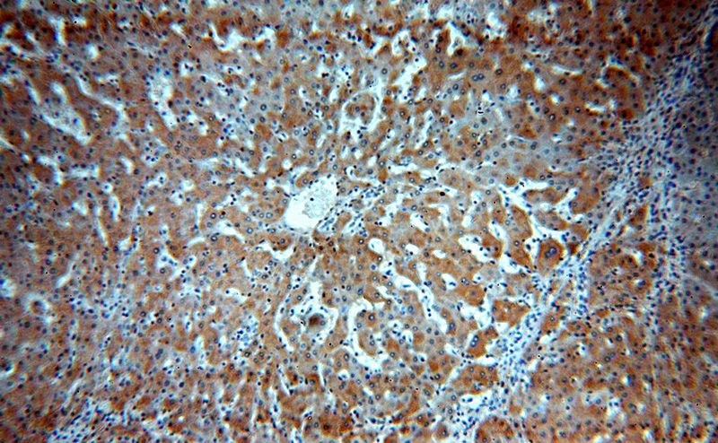 Immunohistochemical of paraffin-embedded human hepatocirrhosis using Catalog No:115639(SPP antibody) at dilution of 1:100 (under 10x lens)