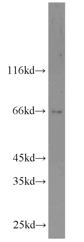 NIH/3T3 cells were subjected to SDS PAGE followed by western blot with Catalog No:109835(DDX5,p68 antibody) at dilution of 1:1000