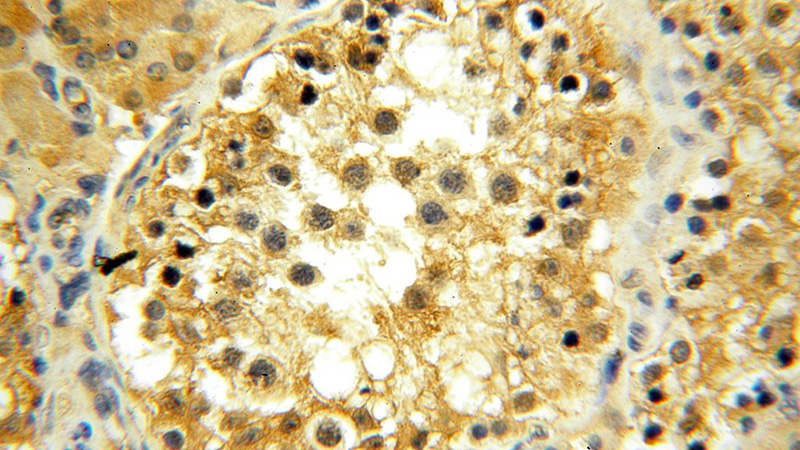 Immunohistochemical of paraffin-embedded human testis using Catalog No:116881(YARS2 antibody) at dilution of 1:100 (under 40x lens)