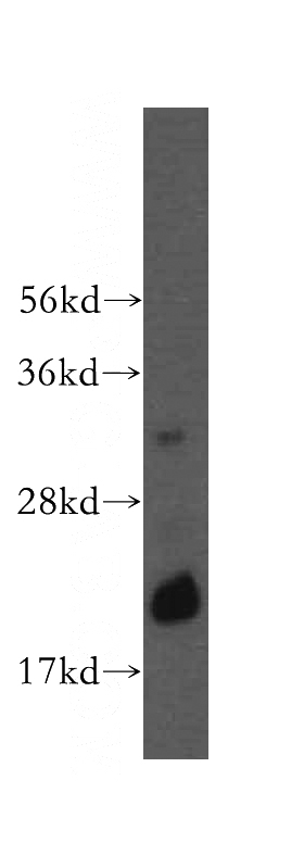 human testis tissue were subjected to SDS PAGE followed by western blot with Catalog No:114731(RNASEH2C antibody) at dilution of 1:600
