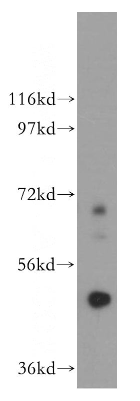 PC-3 cells were subjected to SDS PAGE followed by western blot with Catalog No:108850(CPA5 antibody) at dilution of 1:500