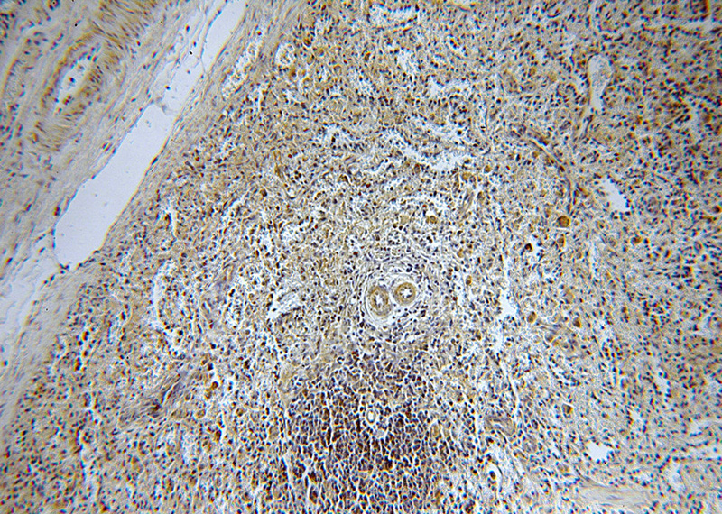 Immunohistochemical of paraffin-embedded human spleen using Catalog No:112319(LRMP antibody) at dilution of 1:100 (under 10x lens)