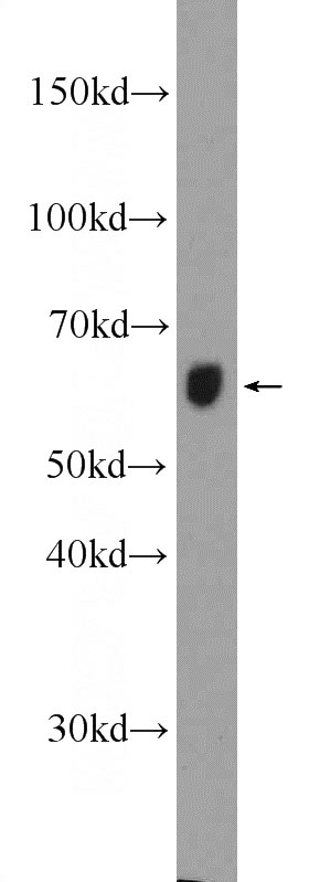 mouse brain tissue were subjected to SDS PAGE followed by western blot with Catalog No:109515(CPNE2 Antibody) at dilution of 1:600