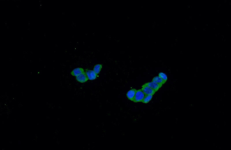 Immunofluorescent analysis of HEK-293 cells using Catalog No:108995(CCHCR1 Antibody) at dilution of 1:50 and Alexa Fluor 488-congugated AffiniPure Goat Anti-Rabbit IgG(H+L)